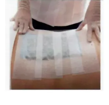 Artcure Diffusional Patch